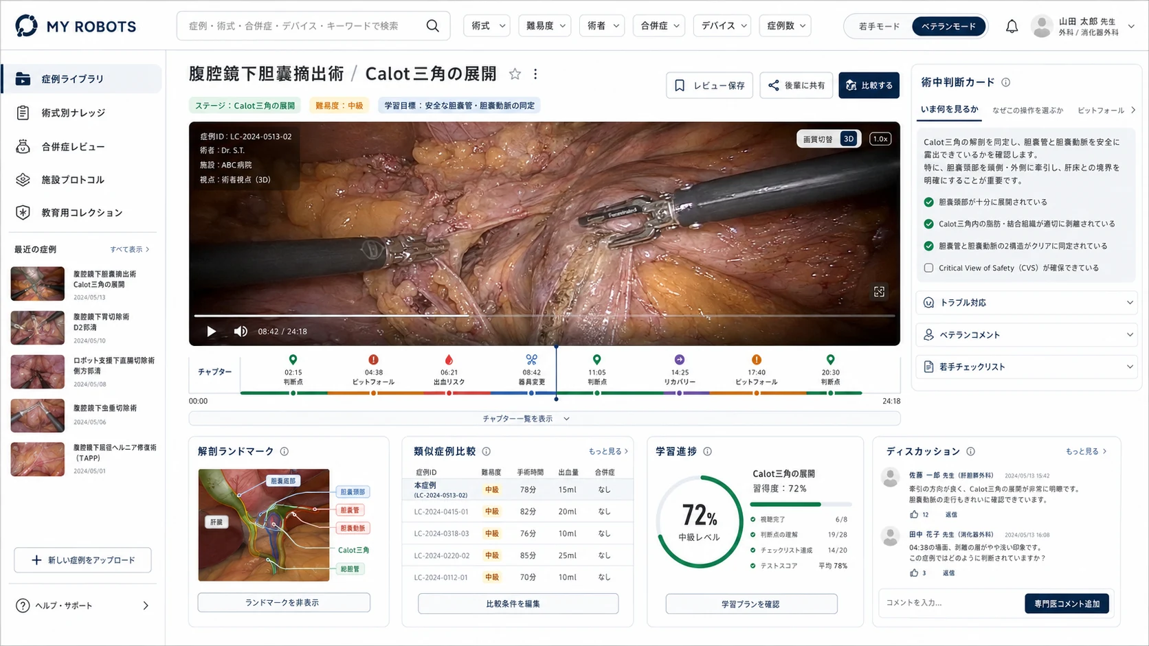 MY ROBOTSの手術知識プラットフォームの開発中画面。手術動画、術中判断カード、解剖ランドマーク、類似症例比較、学習進捗、専門家コメントを表示